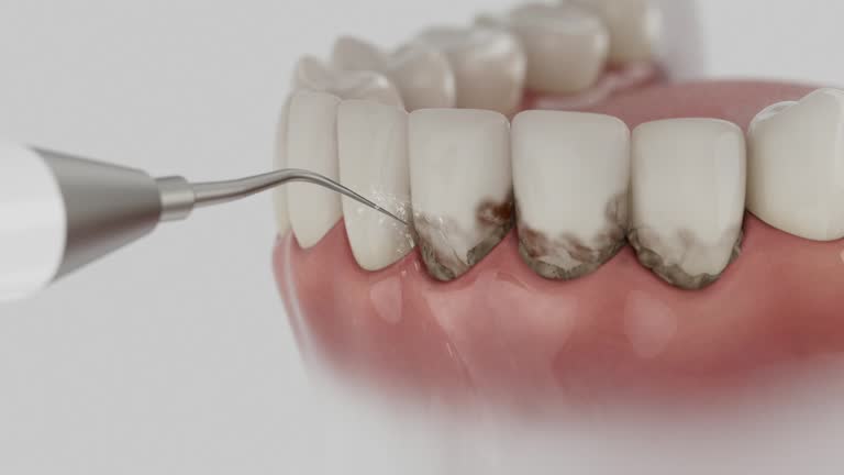 Trusted Teeth Whitening service in Buena Vista, MI - Dentist Open Now